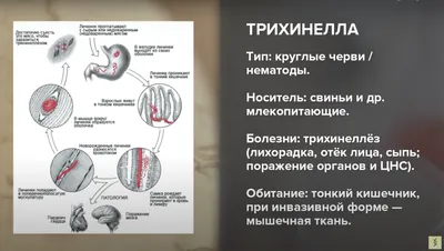 Гельминты: истории из жизни, советы, новости, юмор и картинки — Лучшее |  Пикабу