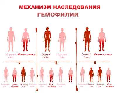 Гемофилия - причины появления, симптомы заболевания, диагностика и способы  лечения