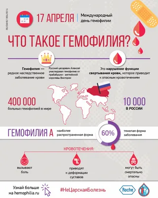 17 апреля- Всемирный день гемофилии. Что о ней нужно знать? – УЗ \"Узденская  центральная районная больница\"УЗ \"Узденская центральная районная больница\"