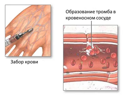 Roche | Редкие среди редких