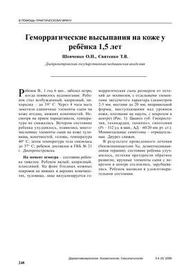 КЛИНИЧЕСКИЕ ПРИМЕРЫ КОЖНОГО ГЕМОРРАГИЧЕСКОГО СИНДРОМА У ДЕТЕЙ – тема  научной статьи по клинической медицине читайте бесплатно текст  научно-исследовательской работы в электронной библиотеке КиберЛенинка