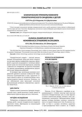 Геморрагический синдромом у детей | Apuntes Pediatría | Docsity