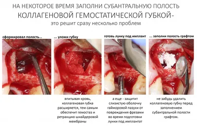 Лебедева Адиса Тумэновна - стоматолог-хирург, имплантолог, пародонтолог |  Dental Dymchikova Club