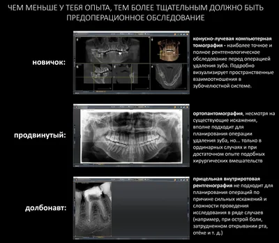 Губка кровоостанавливающая ЗАО \"Зелёная дубрава\" коллагеновая  рассасывающаяся - «Некрасиво. Неудобно. Зато остановили кровотечение. Когда  перекись не помогает, а про клей медицинский я не подумала» | отзывы