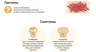 Диагностика и лечение молочницы (кандидоза) в СПб - цены