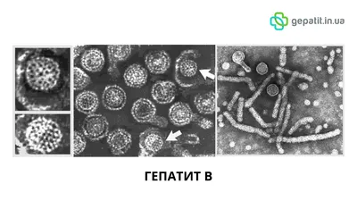 Более 350 млн инфицированных. Что нужно знать о вирусах гепатита?