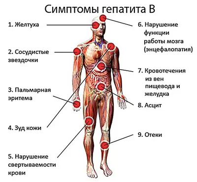 Вирусный гепатит С - это гепатит, вызываемый вирусом гепатита С (HСV). -  ОГАУЗ Поликлиника №4