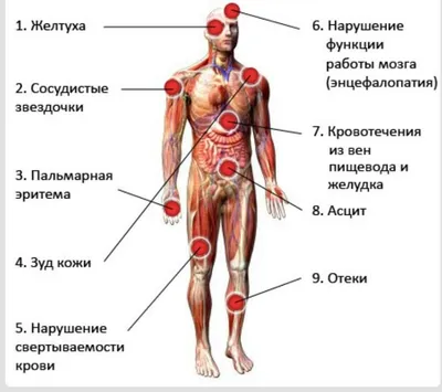 Гепатит А, B, C, D, E. Симптомы, диагностика, лечение.