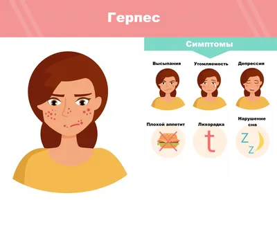 Лечение герпеса на коже и теле | МЦСМП — Международный центр скорой  медицинской помощи