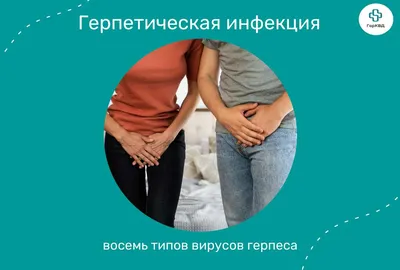 Герпес — Derma.ua