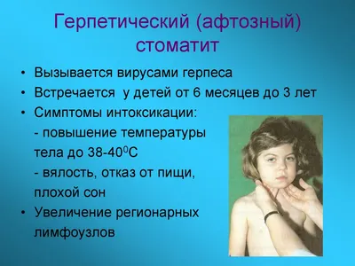 Стоматит у ребенка - как и чем лечить | Блог Daily Medical