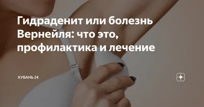 Дезодорант-антиперспирант Rexona Aloe Vera - «Вызвал гидраденит за сутки! +  фото» | отзывы