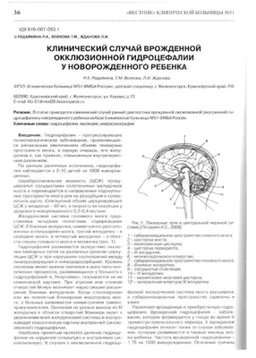 Гидроцефалия и способы ее остеопатического лечения — Советы и рекомендации  специалистов клиники Клиомед в Казани