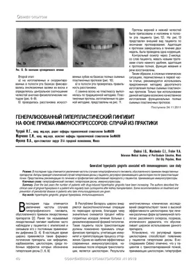 крупным планом изображение зубов с кариесом, картинка гингивит фон картинки  и Фото для бесплатной загрузки