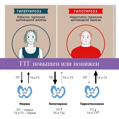 Причины, симптоматика и способы лечения гипотиреоза и гипертиреоза | Ольвица