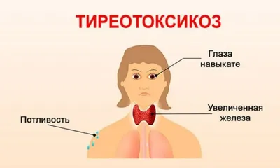 Гипертиреоз - это очень распространенное эндокринное заболевание у  возрастных кошек. Для того, чтобы выявить его на ранних стадиях и… |  Instagram