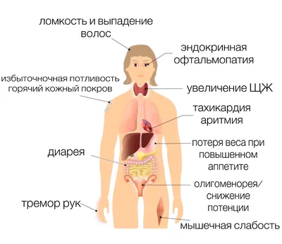 Гипертиреоз щитовидной железы: причины, симптомы, лечение