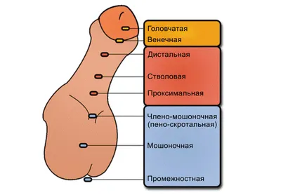 Сравнительный анализ методов лечения дистальной формы гипоспадии у детей