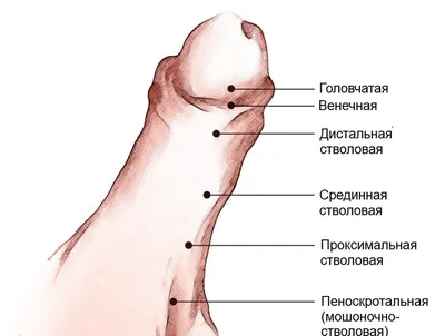 Гипоспадия | Симптомы | Диагностика | Лечение - Lik.ua