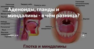 Увеличенные миндалины у ребенка - о чем свидетельствуют?