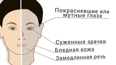 Наркоманов бывших не бывает\". Как стигма мешает наркозависимым - и всему  обществу - BBC News Русская служба