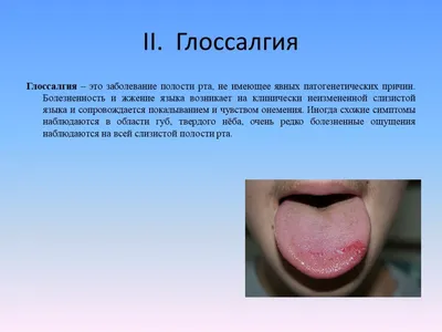 Презентация \"Клиника, диагностика и лечение стомалгии, глоссалгии  (глоссодинии) и дентальной плексалгии.\" – скачать проект