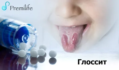 https://www.championat.com/lifestyle/news-5344748-obratites-k-vrachu-tri-priznaka-vo-rtu-mogut-signalizirovat-o-deficite-vitamina-b12.html