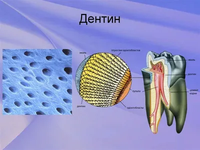 Удаление зуба мудрости - удалить зуб мудрости в Киеве