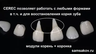 Атравматичное удаление зуба. Dr. Amiyanc. Stavropol city. Clinika DA Vinci.  - YouTube