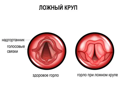 Почему болит ухо? Основные причины боли в ухе. Стреляет ухо: что делать?