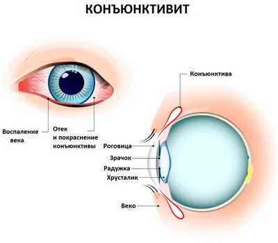 Стоматит - что это, как и чем лечить у детей и взрослых, симптомы, причины