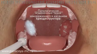 9 неэффективных методов лечения в отоларингологии. Взгляд со стороны  доказательной медицины