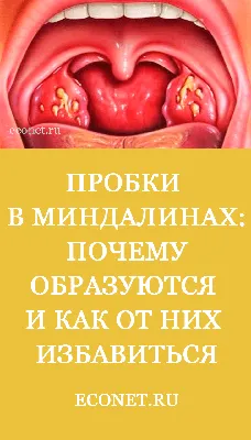 Слизь в горле - сопутствующие симптомы и основные причины | Наш дом в  Новороссийске | Дзен