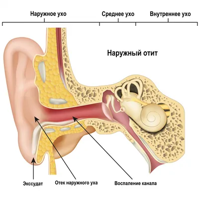 Гнойная ангина