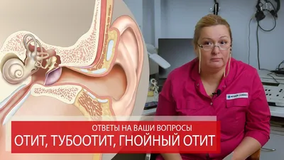 Осложнения острого среднего отита – тема научной статьи по клинической  медицине читайте бесплатно текст научно-исследовательской работы в  электронной библиотеке КиберЛенинка