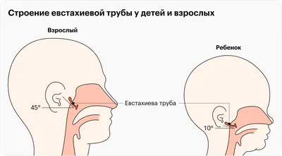 Лечение отита уха в клинике «ЕВРОМЕД» в Кемерово, причины и симптомы  острого отита