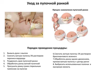 Пупок внутри красный и гноится — 3 ответов | форум Babyblog