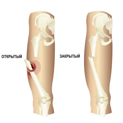 Голень картинка человека