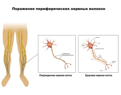 Голень человека - значение, заболевания, протезирование :: SYL.ru