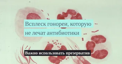 гонорея / смешные картинки и другие приколы: комиксы, гиф анимация, видео,  лучший интеллектуальный юмор.