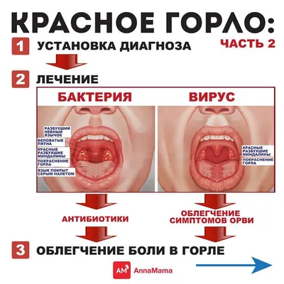 Осмотр или мазок из горла на тест | Пикабу