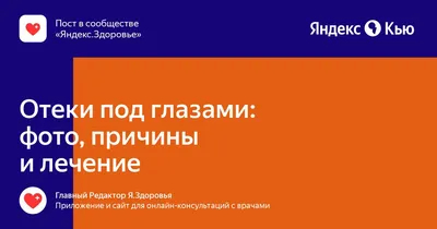 11 способов снять отечность ног в домашних условиях — Блог  интернет-магазина Shoe Care