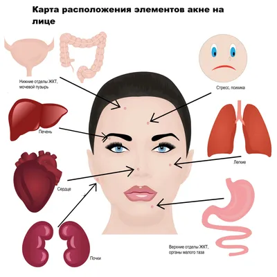 Лечение акне и постакне в Ижевске