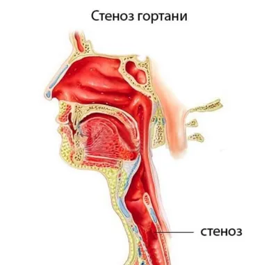 Гортань 3D model - Скачать Анатомия на 3DModels.org