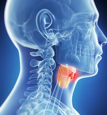 Папилломатоз гортани – причины, симптомы, диагностика и лечение | «Будь  Здоров»