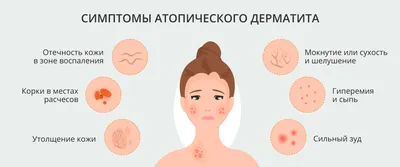 Грибковая инфекция в пахе, псориаз, дерматит, Eczema Стоковое Фото -  изображение насчитывающей грибково, аллергически: 142969758