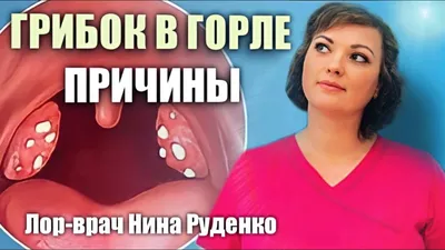 Семейная Клиника Family Health Clinic - #Repost @doctor.zhuldyz with  @make_repost ・・・ Я уверена, что каждый человек в жизни испытывал боль в  горле(ТОНЗИЛЛОФАРИНГИТ) Заглянули в горле, увидели белый налёт и многие  думают, АНГИНА!