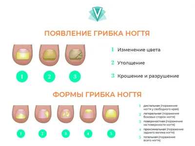 Купить гель Грибок Протект от грибка ногтей цена в аптеке , состав и  инструкция по применению