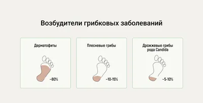 Избавление от грибка (микоза) стопы — Центре подологии СТОПАМЕР