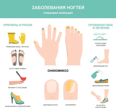 Лечение грибка кожи, ногтей, волос в Киеве | Brenner Clinic